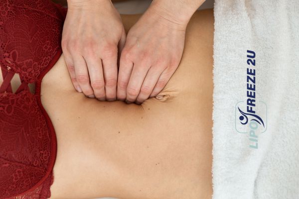 diastasis recti treatment Melksham