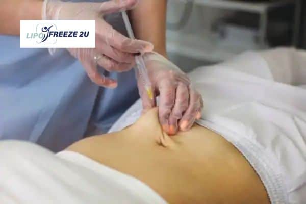Fat Dissolving Injections Melksham & Weight loss medication