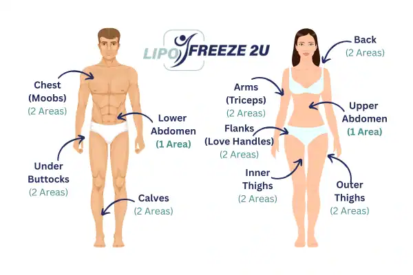 Areas you can have fat freezing treatment Melksham