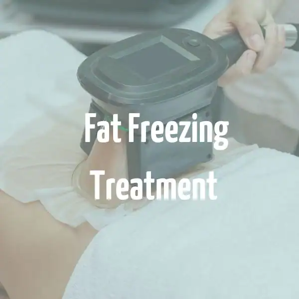 fat freezing treatment Melksham