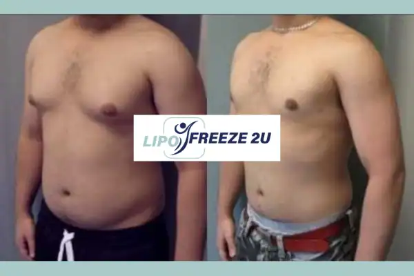 How Long Does It Take to See Results Melksham?