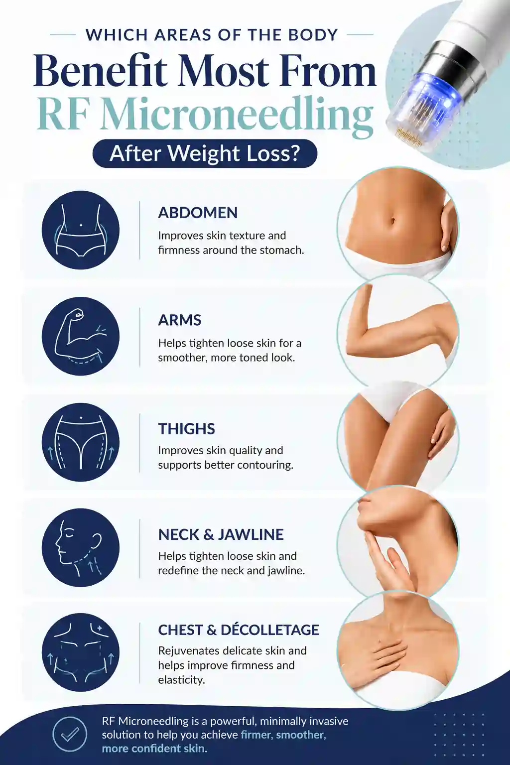 Which Areas of the Body Benefit Most From RF Microneedling After Weight Loss Melksham